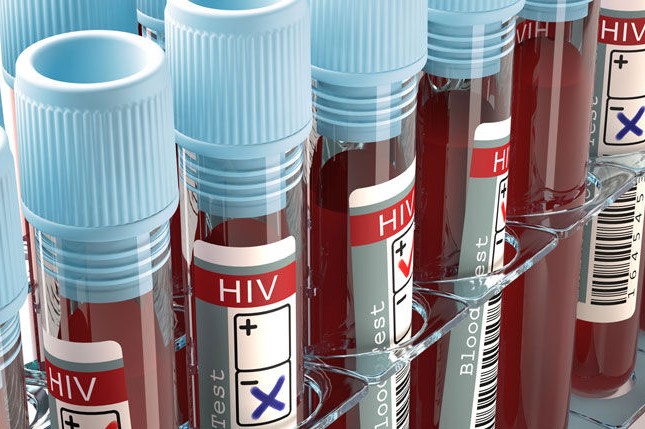 روابط جنسی، بیشترین سهم در انتقال ویروس HIV را دارد