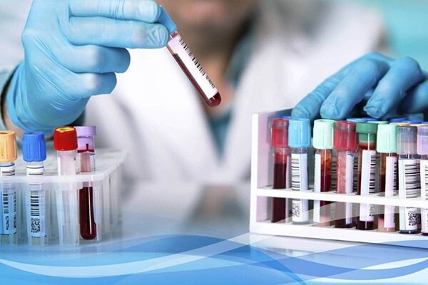 اعتماد اتحادیه اروپا به آزمایشگاههای مرجع ایران اعتماد اتحادیه اروپا به آزمایشگاههای مرجع ایران